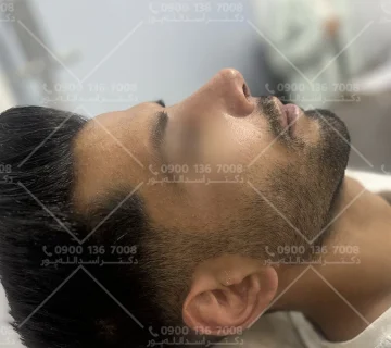 بارداری و جراحی بینی دکتر اسدالله پور
